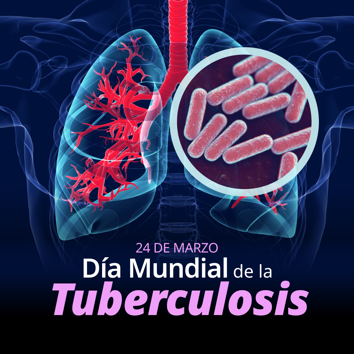 “¡Sí! ¡Podemos acabar con la tuberculosis!”